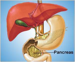 Stress Granules Drive Obesity-associated Pancreatic Cancer
