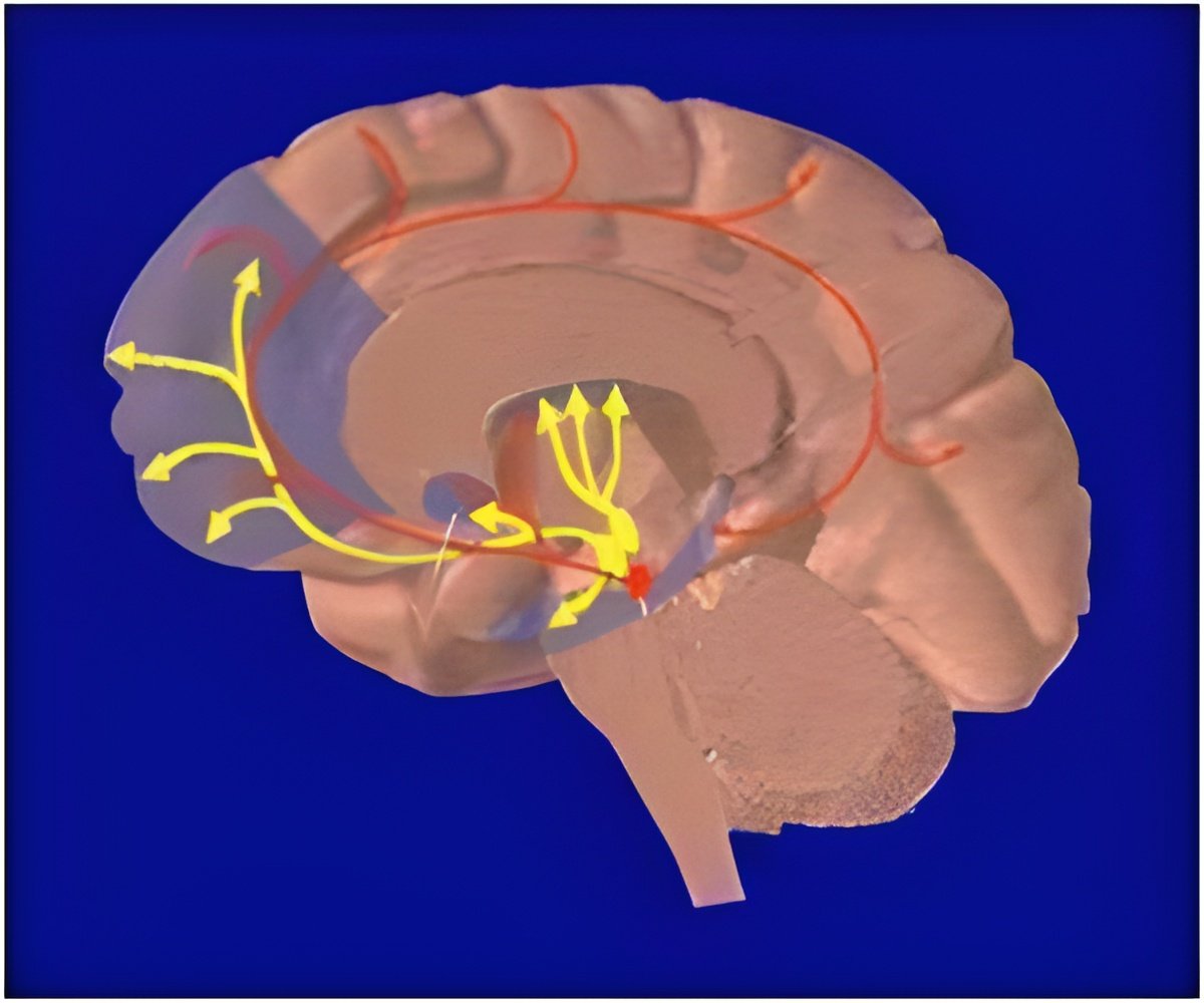 Brain Care Score Linked to Lower Risk of Late-Life Depression